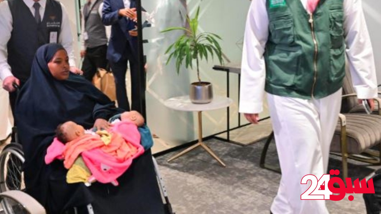 صور| التوأم الملتصق الصومالي “رحمة ورملا” يصلان الرياض لدراسة حالتهما